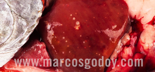Bacterial kidney diseases - Gross pathology X