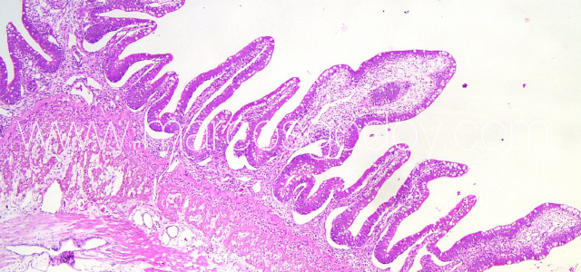 Gut edema histopathology II