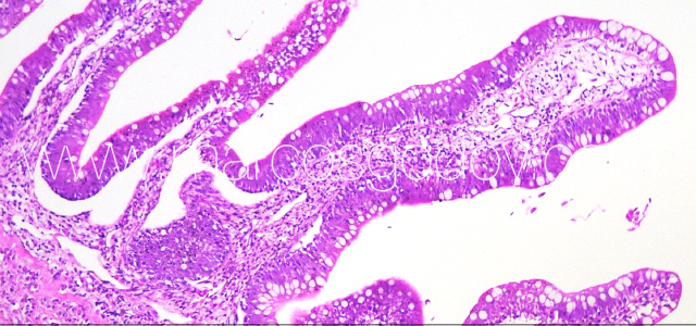 Gut edema histopathology III