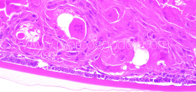 Atlantic salmon cataract histopathology V