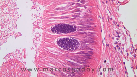 osotomayor_00265