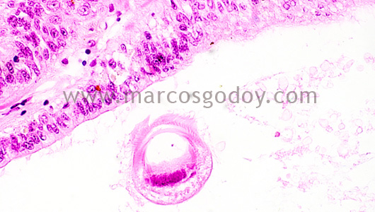 trichodina-1