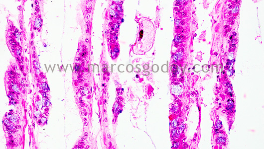 trichodina-loco-4