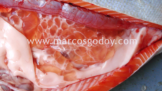 cyst-4 cyst-4