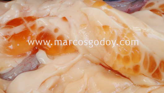 cyst-5 cyst-5