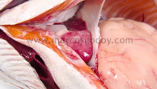 epicarditis-2