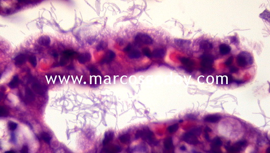 flavobacterium-ii