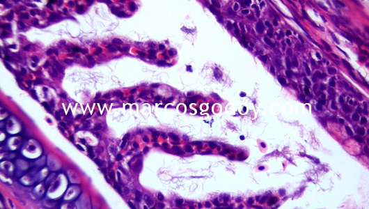flavobacterium-iii