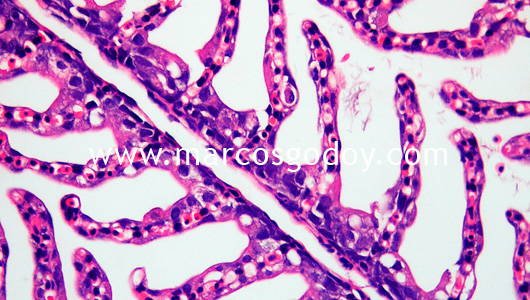 flavobacterium-iv