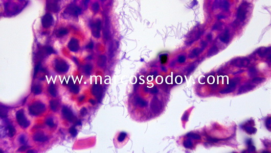 flavobacterium-v