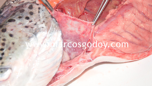 hydromericardio-pericarditis-i