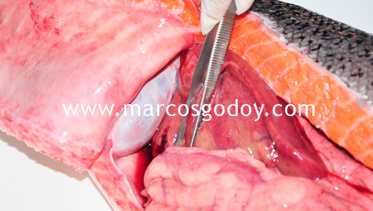 hydromericardio-pericarditis-v