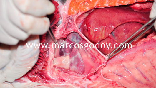 hydromericardio-pericarditis-vi