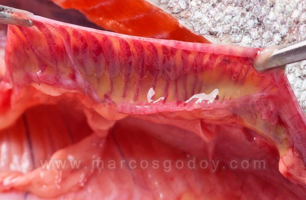 Patologías gastrointestinales: Enteritis