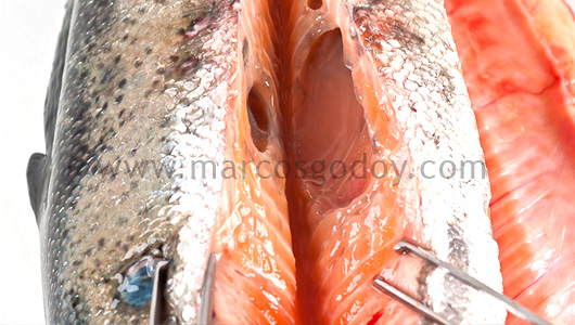 abscess-ii