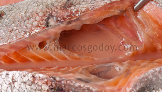 abscess-iii
