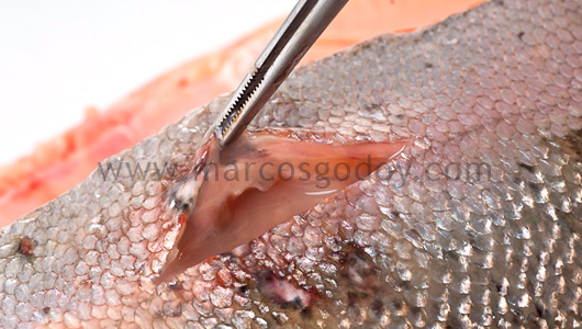 abscess-vi