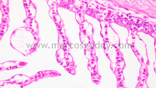 gill-oedema-i