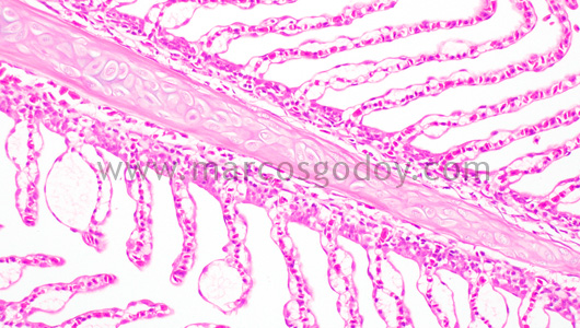 gill-oedema-ii1