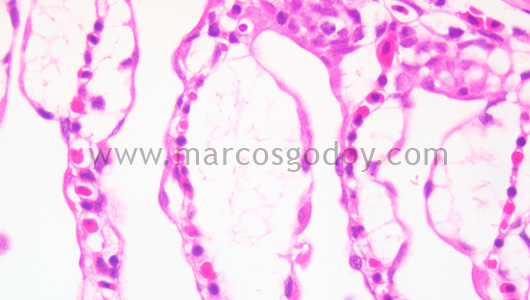gill-oedema-iii