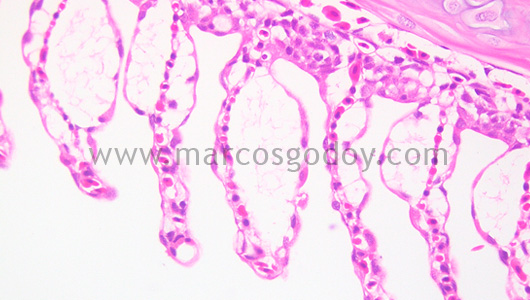 gill-oedema-iv