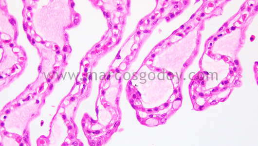 gill-oedema-v