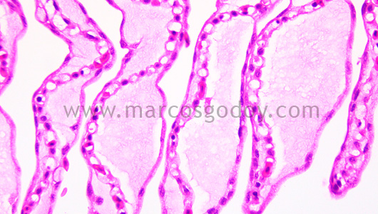 gill-oedema-vi