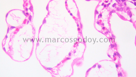 gill-oedema-vii