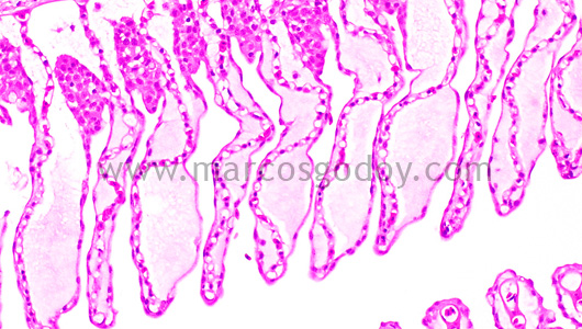 gill-oedema-viii