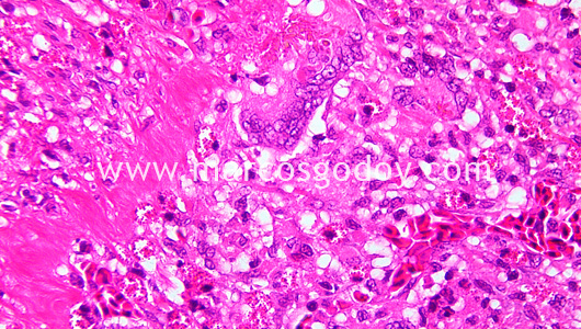 enteritis-iii enteritis-iii