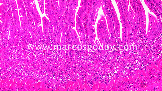 enteritis-vi1 enteritis-vi1