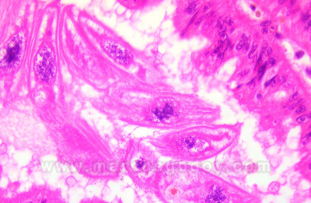 Parasitismo branquial por protozoos ciliados en abalón rojo (Haliosits rufescens)