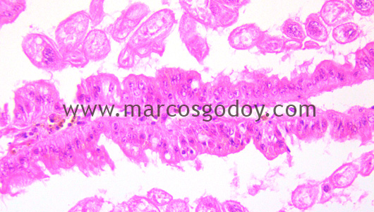 gill-abalone-protozoa-ciliated-iii gill-abalone-protozoa-ciliated-iii