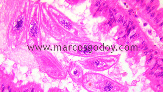 gill-abalone-protozoa-ciliated-iv gill-abalone-protozoa-ciliated-iv