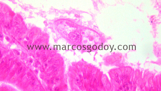gill-abalone-protozoa-ciliated-v gill-abalone-protozoa-ciliated-v