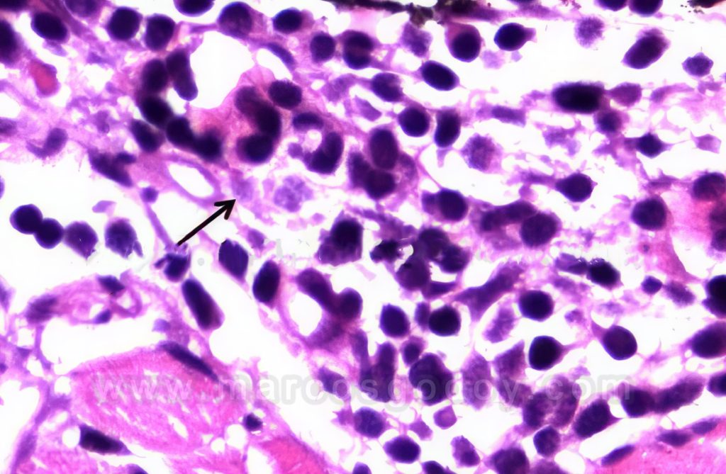 Dermatitis por Caligus rogercresseyi, Chalimus en Salmón del Atlantico (Salmo salar) I: Histopatología