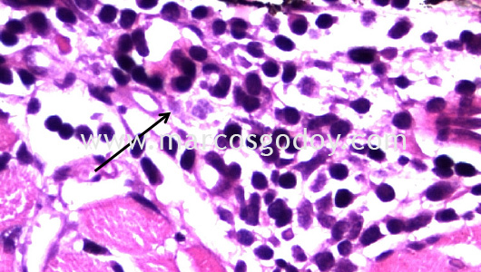 dermatitis-ii dermatitis-ii