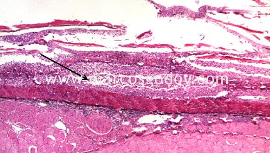 dermatitis-v dermatitis-v