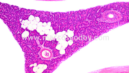 ipnv-post-sewater-transfer-histopathology-i