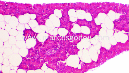 ipnv-post-sewater-transfer-histopathology-ii