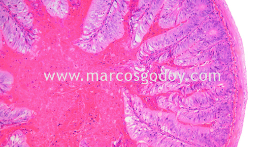 ipnv-post-sewater-transfer-histopathology-iv