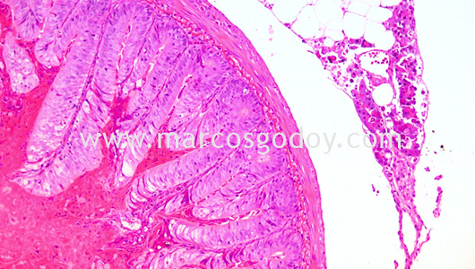 ipnv-post-sewater-transfer-histopathology-ix