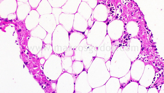 ipnv-post-sewater-transfer-histopathology-v