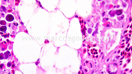 ipnv-post-sewater-transfer-histopathology-vii