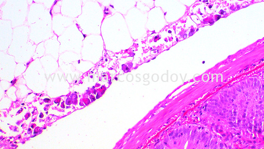 ipnv-post-sewater-transfer-histopathology-viii