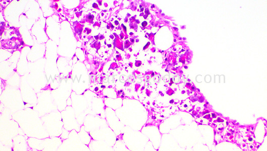 ipnv-post-sewater-transfer-histopathology-x