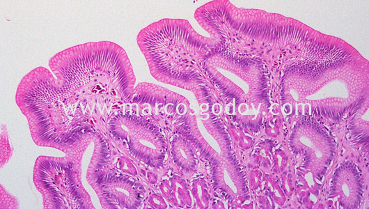 gastric-dilatation-histopatology gastric-dilatation-histopatology