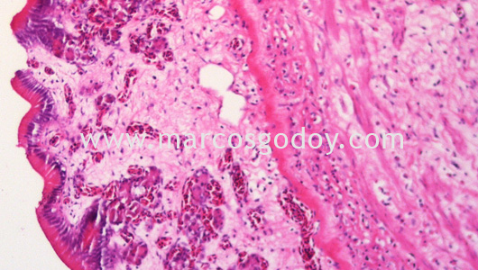 gastric-dilatation-histopatology-ii gastric-dilatation-histopatology-ii