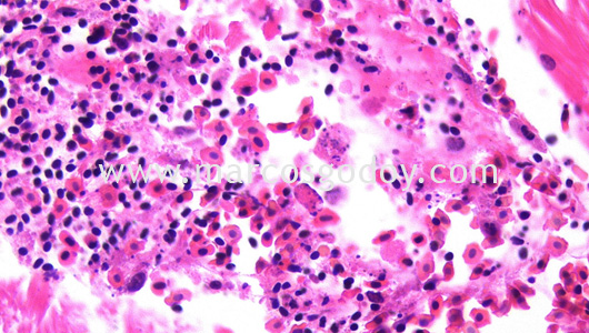 necrotizing-myositis-by-piscirickettsia-salmonis-i necrotizing-myositis-by-piscirickettsia-salmonis-i