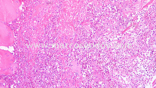necrotizing-myositis-by-piscirickettsia-salmonis-ii necrotizing-myositis-by-piscirickettsia-salmonis-ii